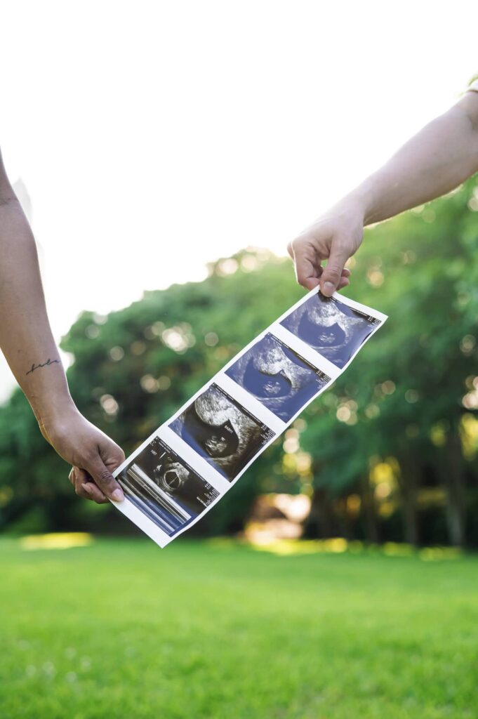 Baby Announcement in Arsenal Park near the State Capital in Baton Rouge, Louisiana